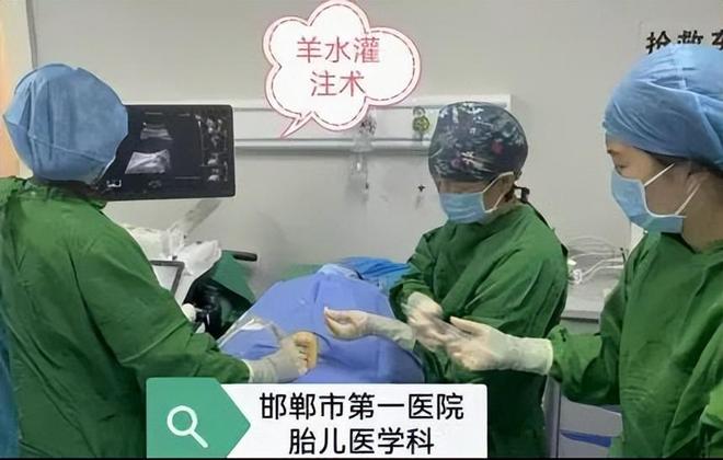 【邯鄲首例】邯鄲市第一醫(yī)院成功實(shí)施胎兒羊水灌注術(shù)(圖1)
